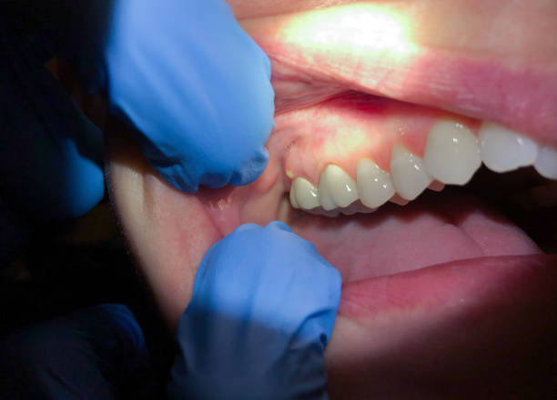 Best Emergency Tooth Extraction  in Randallstown, MD