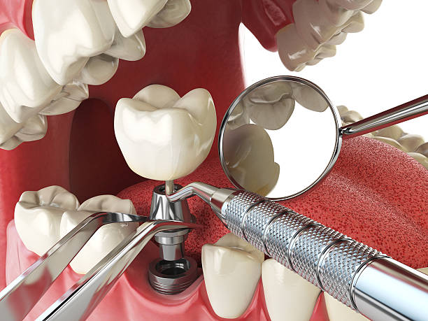 Best Affordable Emergency Dental Care  in Randallstown, MD